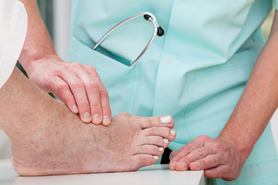 Doctor checking the bunion condition