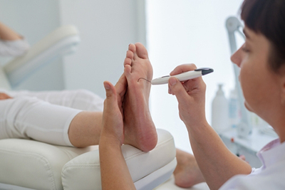 Neuropathy exam using a monofilament by a podiatrist